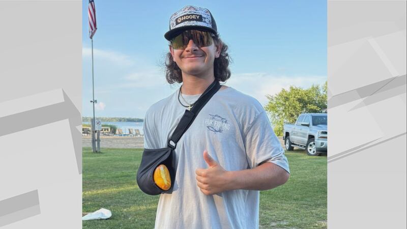 Last week, Parker Ball was shooting off fireworks with friends when a mortar tube blew up in...